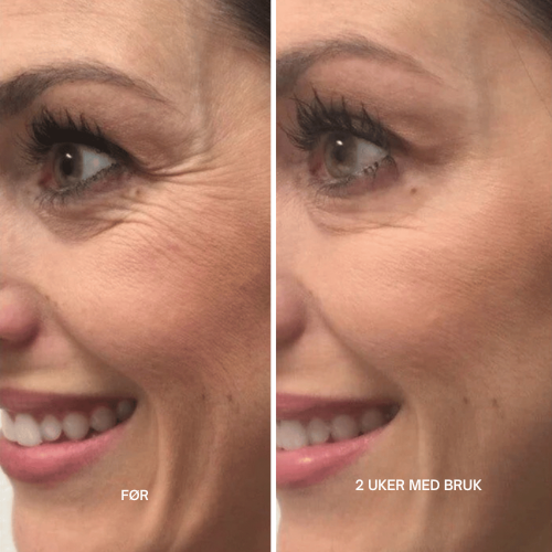 Lunora™ Det næste generations alternativ til retinol